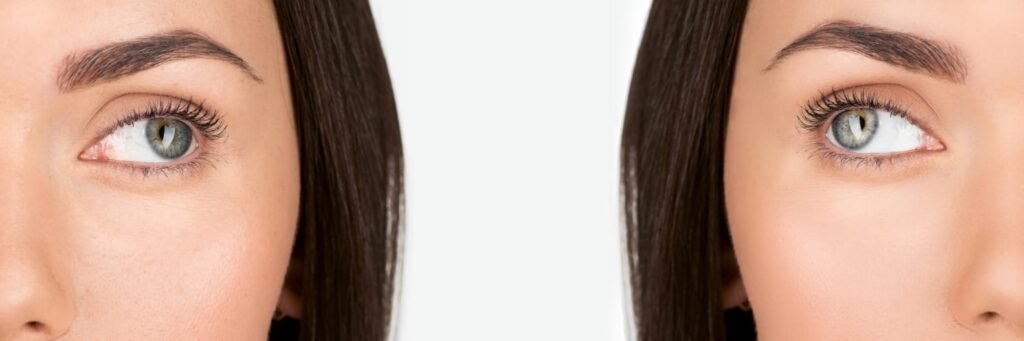 protección de la piel